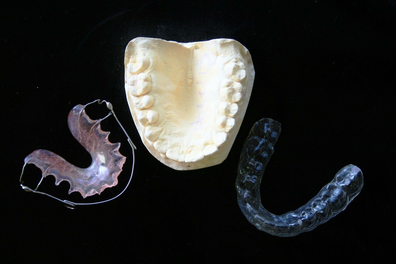 Zahnspangen bei Kieferschmerzen